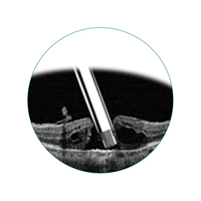 UN-5012（23G）笛针